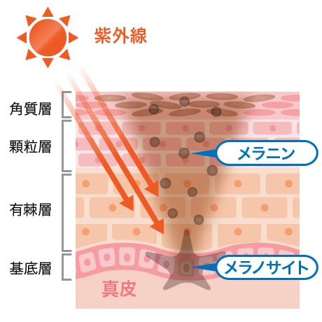 紫外線