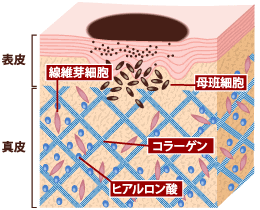 ほくろ・イボの原因