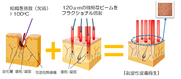 皮膚再生のしくみ