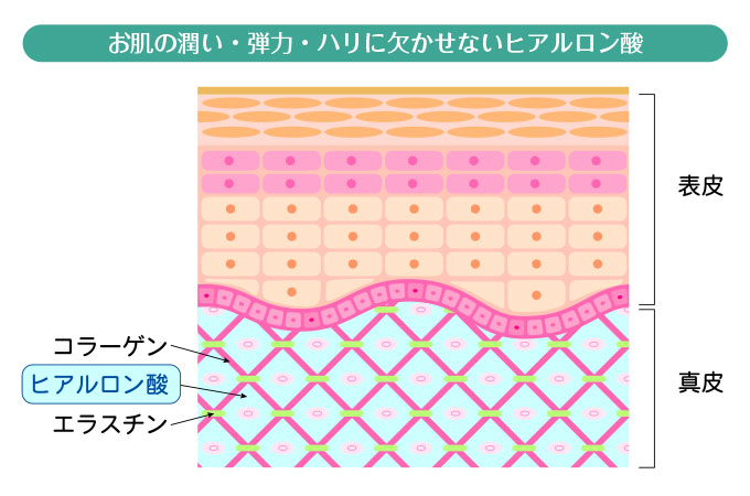 ヒアルロン酸