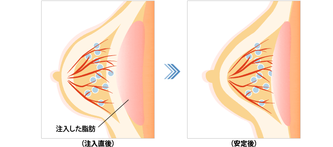 施術 イメージ