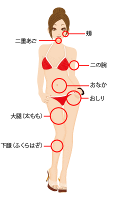 各部位の脂肪吸引