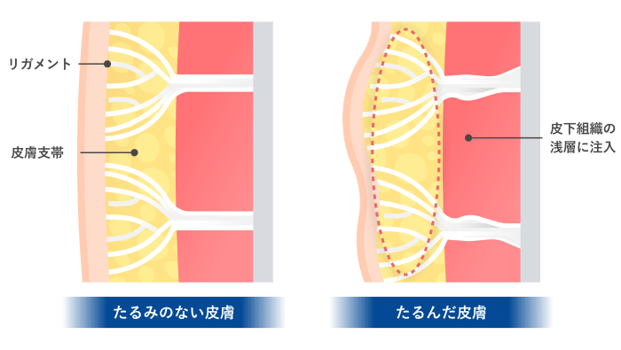 肌のハリ・弾力のある肌を再構築