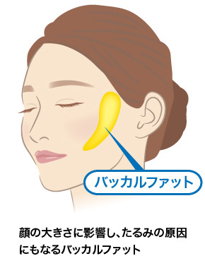 ファット は バッカル と 【症例写真】バッカルファット除去｜術前〜6日後〜1ヶ月後