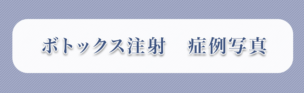 眉毛アートメイク　症例写真