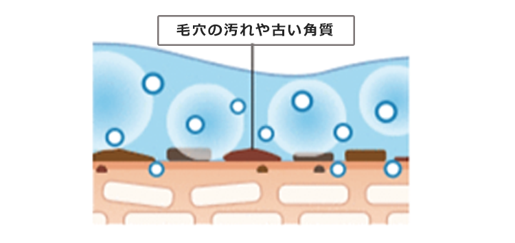 少ない回数で効果を実感