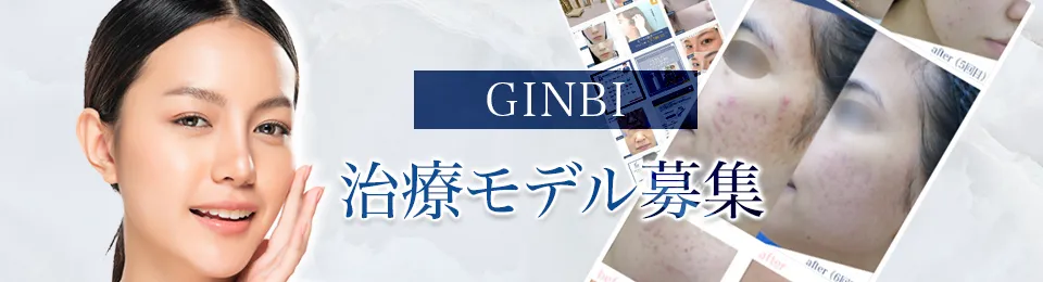 GINBI治療モデル（モニター）募集