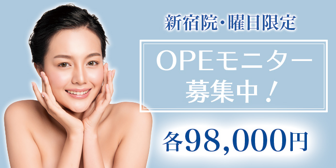 OPEモニター大募集